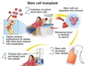 बोन मेरो ट्रांसप्लांट से मिला 11 वर्षीय कौशिक को नया जीवन