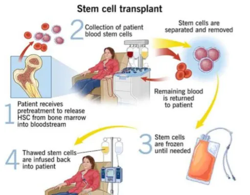 बोन मेरो ट्रांसप्लांट से मिला 11 वर्षीय कौशिक को नया जीवन