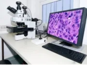 सांसद के प्रयासों से – अब बायोप्सी के सैंपल नही भेजने होंगे नागपुर, छिंदवाड़ा में ही होगी जांच