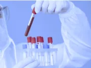 सावधान : पैथोलॉजी लैब के औचक निरीक्षण में मिले अप्रशिक्षत लैब टैक्नीशियन…