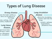 पटाखों का धुआं फेफड़ों के लिए हानिकारक, छोटे बच्चों को रखें धुएं से दूर