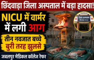 छिंदवाड़ा जिला अस्पताल के NICU में वार्मर में लगी आग, तीन नवजात झुलसे; जबलपुर मेडिकल कॉलेज रेफर